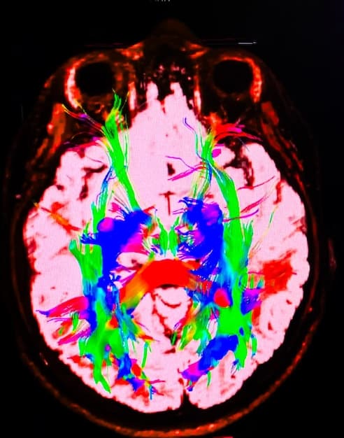 A brain scan image showing reduced activity in the amygdala (the brain's fear center) after consistent mindfulness meditation practice. The image highlights the neurological impact of meditation on stress reduction.